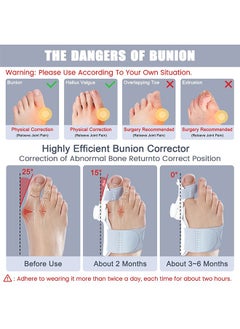 Unik Bunion Corrector Adjustable, Knob Bunion Corrector for Women and Men Big Toe,Orthopedic Toe Straightener Suitable for Left and Right Feet  - Image 2