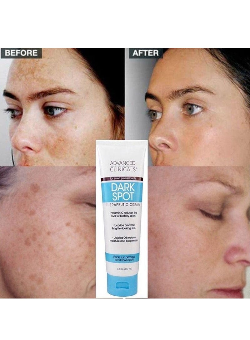 Advanced Clinicals Dark Spot Vitamin C Cream For Face, Hand & Body Lotion, Anti Aging Therapeutic Skin Care Moisturizer Lotion Reduces Appearance Of Age Spots, Blotchy Skin, & Wrinkles, Large 8 Fl Oz - Image 3