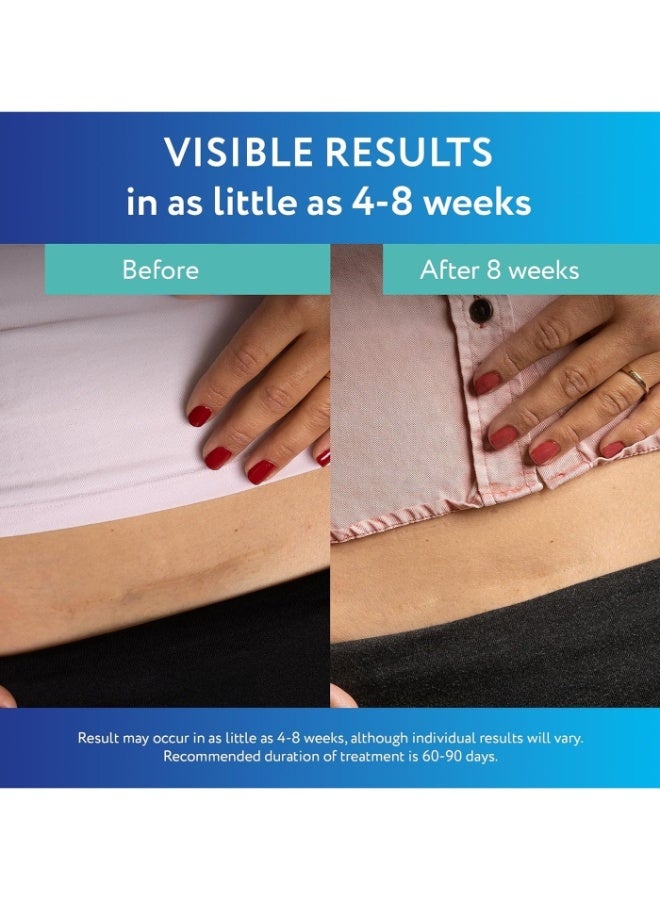 سكار أواي Clear Silicone Scar Sheets, White, 6 Count - Image 3