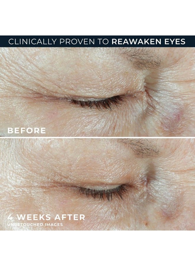 RoC Hydration + Eye Cream, 0.5 fl oz (15 ml) - Image 5