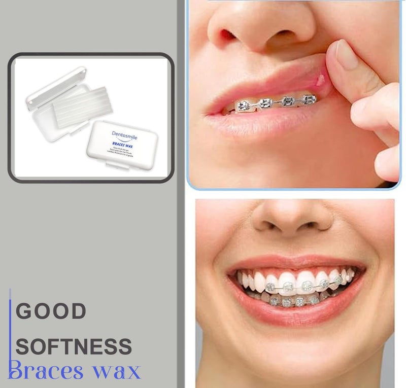 Dentosmile Unisex Adult Dental Orthodontic Wax For Braces/Bracket Gum - 5 Strips Per Box/Pack Of 1 - Image 5
