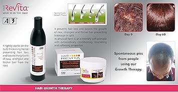 A3 Hair Revita Anti Chute Shampoo 300 ml - Image 2