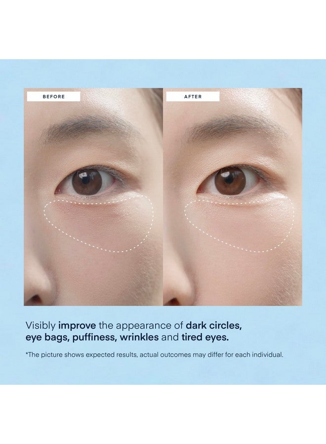TEREZ & HONOR Under Eye Patches for Dark Circles: Puffiness & Eye Bag Treatment Gel Mask with Caffeine Hyaluronic Acid Niacinamide - Undereye Brightening Hydrating Anti-Wrinkle & Cooling - Korean Skincare, 30 Pairs - Image 4