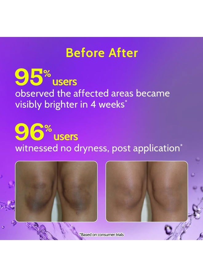 Chemist at Play سيروم رول أون لتفتيح وتبييض الرقبة والركبة والكوع مع 6% فيتامين C + حمض الهيالورونيك + AHA + نياسيناميد + سيراميدات | يزيل التصبغات ويرطب البشرة الجافة | 40 مل - Image 4