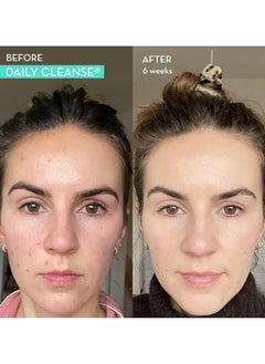 HUM Daily Cleanse, Cleanses Body Clears Skin 60 Vegan Capsules  - Image 3