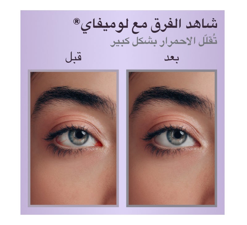 Lumify Eye Drops 0.25 Fl Oz 7.5 Ml - Image 3