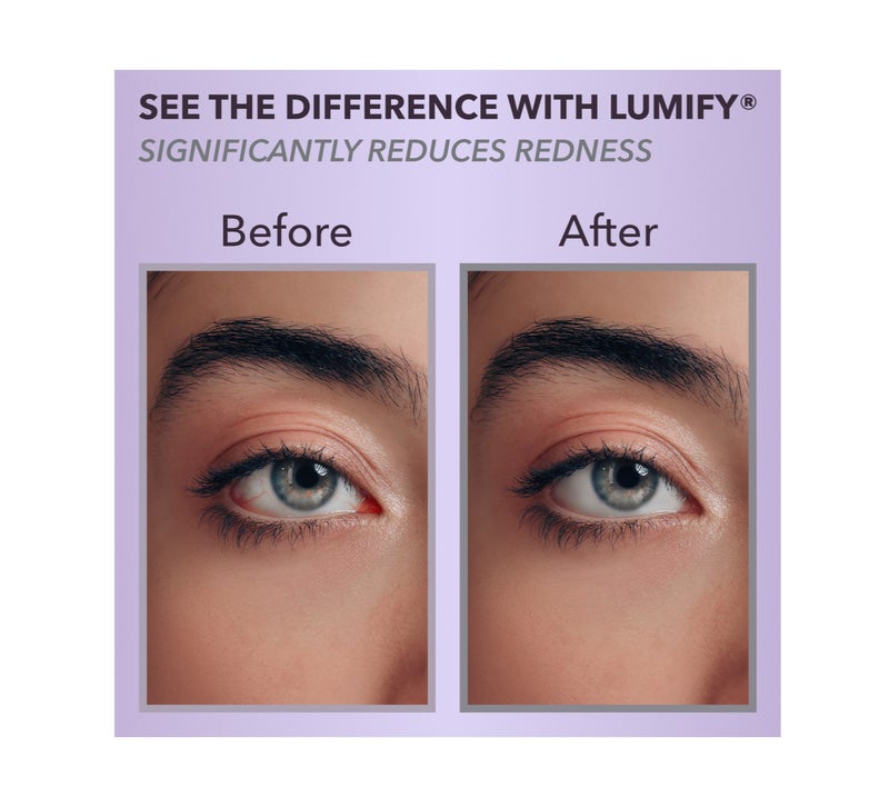 Lumify Eye Drops 0.25 Fl Oz 7.5 Ml - Image 5