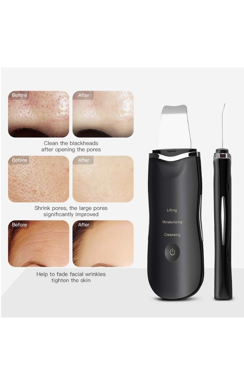 منجل الوجه لتنظيف الأيونات العميقة ومضغف التفحيم ومحاسبة التنظيف الشحنABLE ماساجر الجمال، جهاز إزالة البثور وإزالة حب الشمس وتقشير الرقي ومراقبة البشرة اللون الأبيض. - Image 4