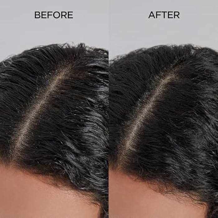 AYUNCHE Refreshing Shampoo for Oily Scalp, 11.8oz Purifying & Cool Down | Powerful Cooling & Deep Cleansing | Anti-Dandruff Shampoo | Korean Salon Brand - Image 5