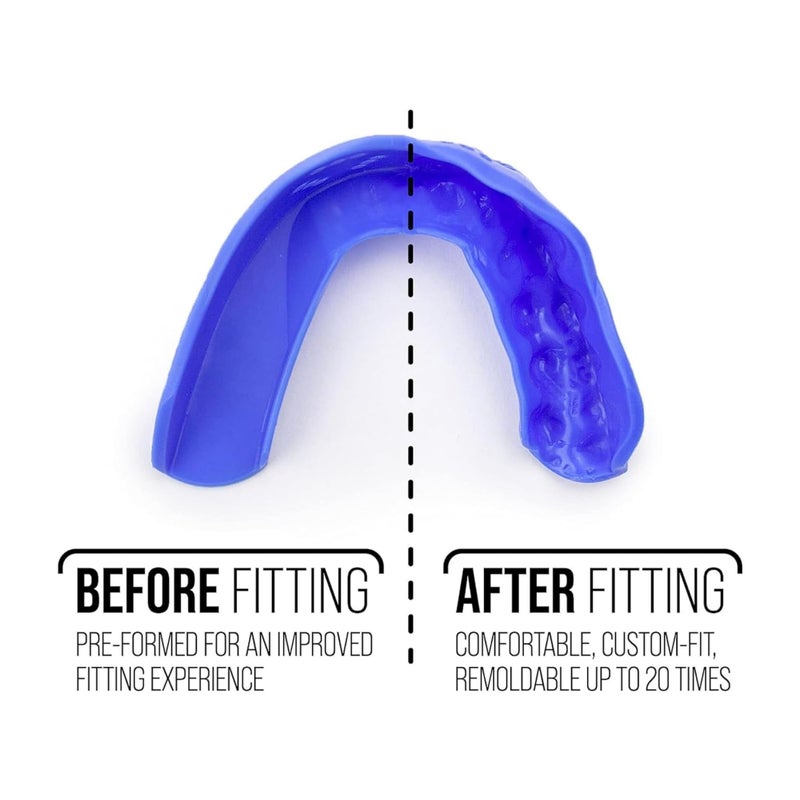 SISU 3D Mouthguard, Charcoal Black - 2.0mm Thin - for Athletes Over 5’ Tall - Pre-Formed for Custom-Molded Fit - Remoldable Up to 20 Times - Non Toxic - Image 5