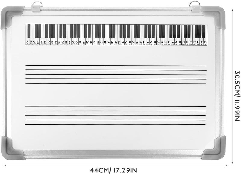 Uonlytech Musical Staff Whiteboard Dry Erase Board 30x40cm Double-Sided Hanging Writing Board for Music Teaching Practice Classroom Use - Image 2