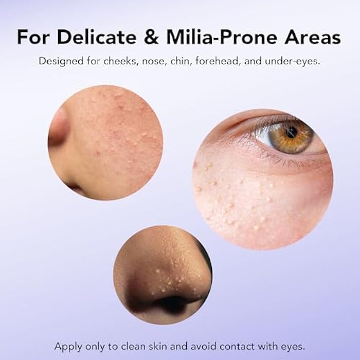 DERMFREE MILIA REMOVER 30 mL Milia Remover Treatment, Milia Spot Treatment with Salicylic Acid Milia Acne Serum Clearing Skin Essence - Image 5