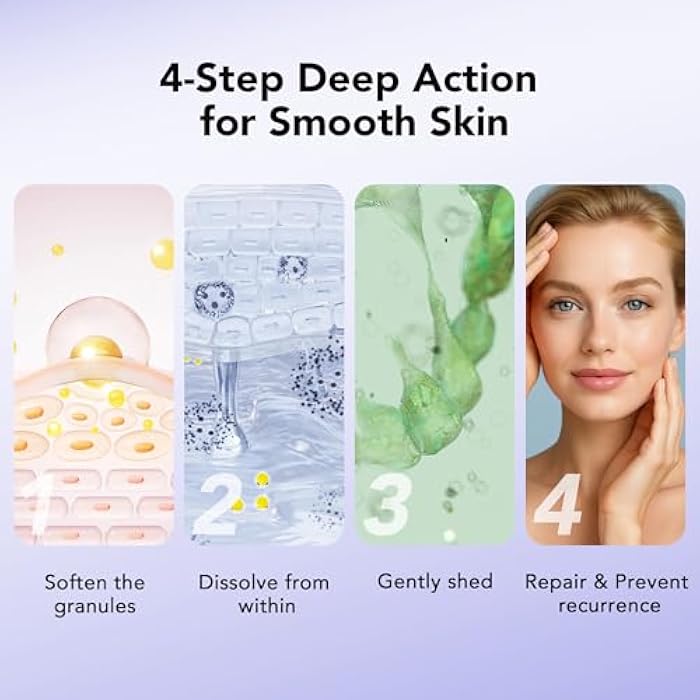 DERMFREE MILIA REMOVER 30 mL Milia Remover Treatment, Milia Spot Treatment with Salicylic Acid Milia Acne Serum Clearing Skin Essence - Image 3