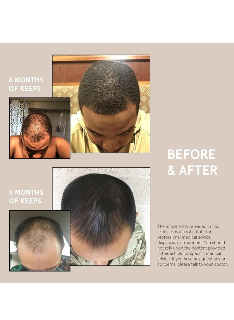 Keeps Extra Strength Minoxidil for Men - 5% Minoxidil Foam Hair Loss & Regrowth Treatment for Thinning & Bald Spots - Clinically Proven Hair Growth Products - Unscented Topical Aerosol Foam - Image 1