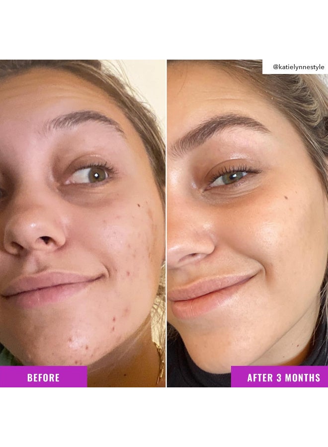 Good Molecules Niacinamide Brightening Toner - Toner for Face with Niacinamide and Arbutin for Skin Tone Balancing- Pore Minimizer, Facial Skin Care - Image 4