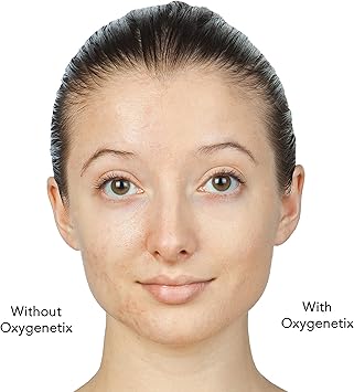 Oxygenetix Breathable Foundation 15 ml Honey - Image 4