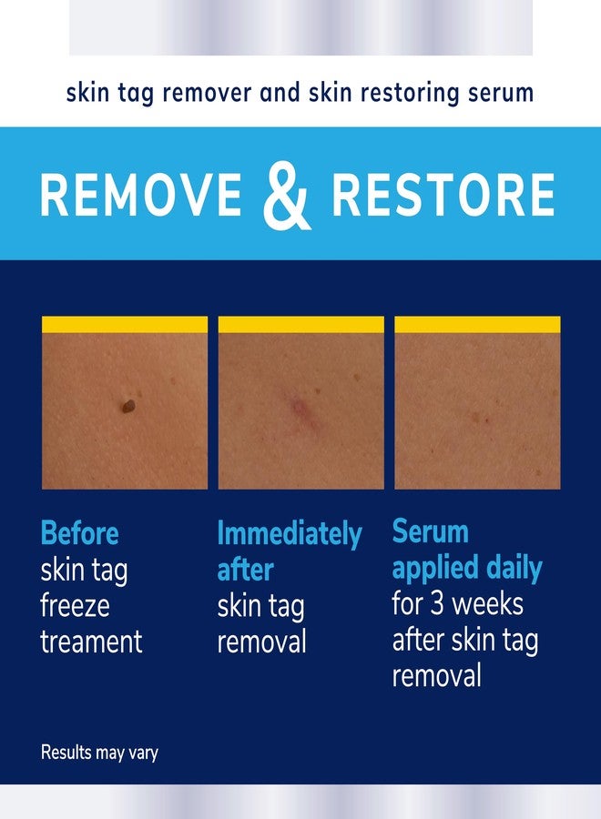 Dr. Scholl's Complete Care Skin TAG Remover, 12 Ct // Removes Skin Tags & Restores Skin's Appearance, FDA-Cleared, Clinically Proven, 12 Treatments Plus Hydrating Serum - Image 5