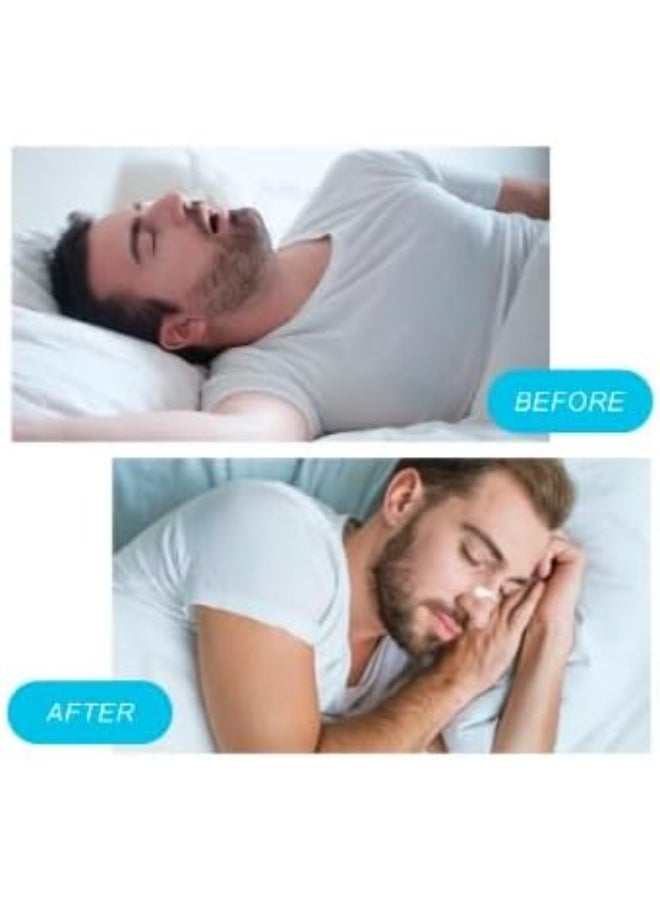 Premium Nasal Dilator Strips, 15 Count, Anti-Snoring Sleep Aid, Congestion Relief (White) - Image 2