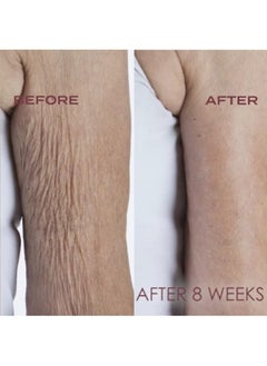 Crepe Erase Crépe Erase Advanced Body Repair Treatment Anti Aging Wrinkle Cream For Face And Body Support Skins Natural Elastin & Collagen Production 10Oz (Fragrance Free)  - Image 5