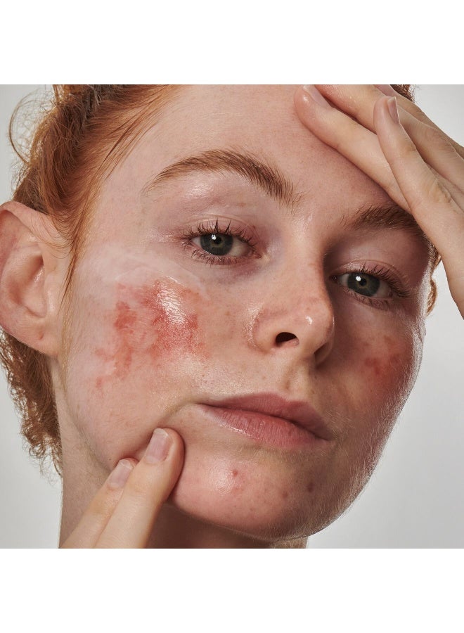 سيروم حمض الأزيليك بتركيز 10% من ذا إنكي ليست سوبر سوليوشنز - Image 3