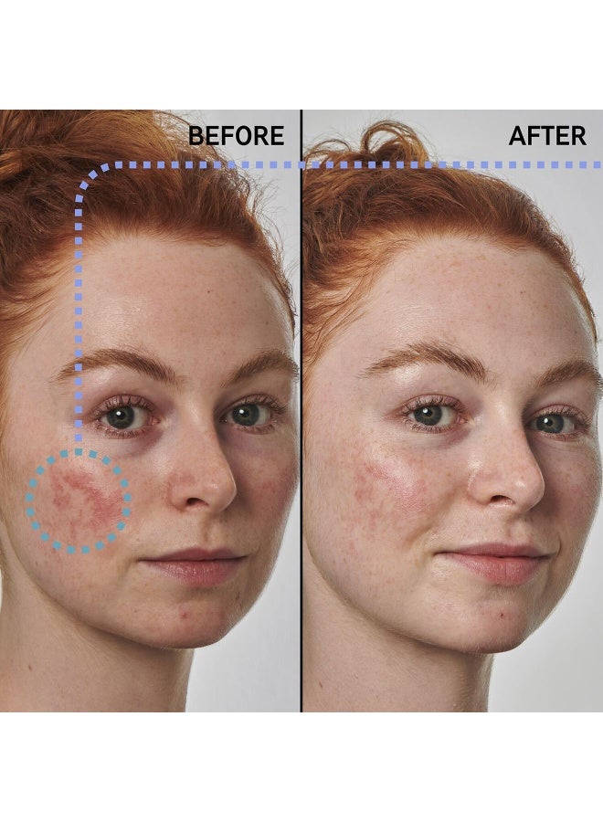 سيروم حمض الأزيليك بتركيز 10% من ذا إنكي ليست سوبر سوليوشنز - Image 4