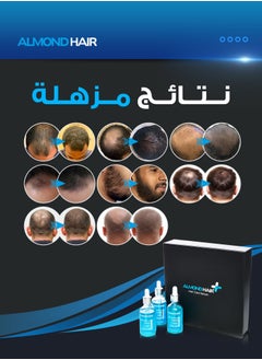 الموند هير مجموعة سيروم العناية بالشعر 3 قطع  - Image 5