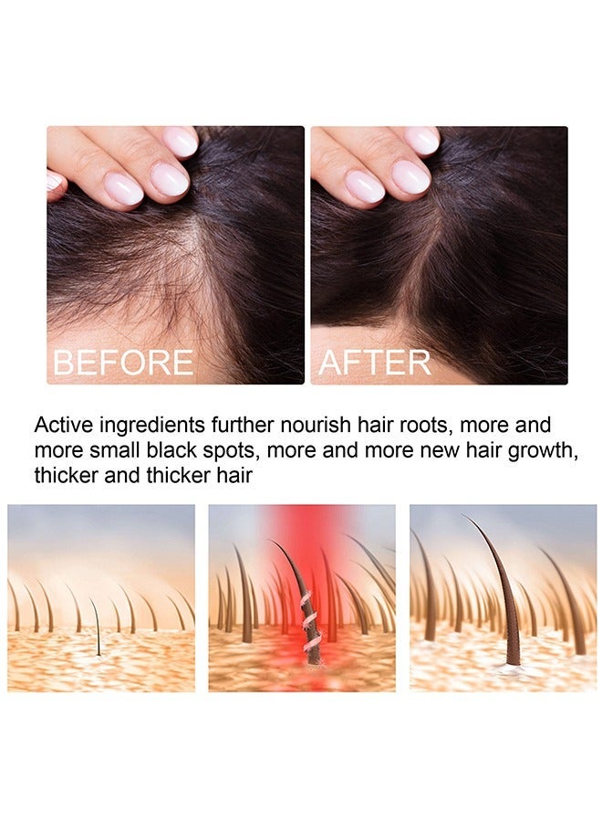 EELHOE Hair growth spray, Rapid Growth Hair Treatment 7 Day Hair Growth Serum Essence Oil Regrow, Ginger Essential Oil Stop Hair Loss Hair, Thinning Treatment Hair Growth Oil for Women & Men 20ml - Image 4