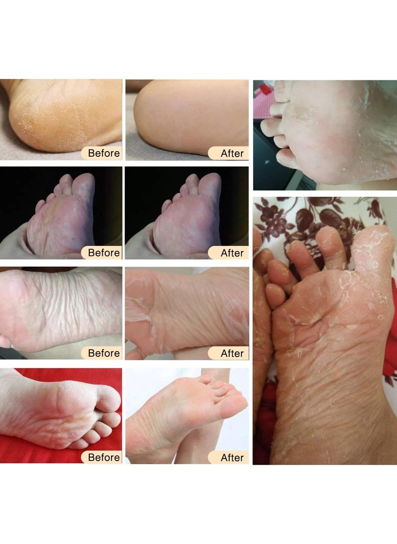 ALIVER - 5 Pairs Foot Peel Mask, Exfoliating Callus Peel Booties, Peeling Off Calluses & Dead Skin, Baby Soft Smooth Touch Feet-Men Women (Rose) - Image 1