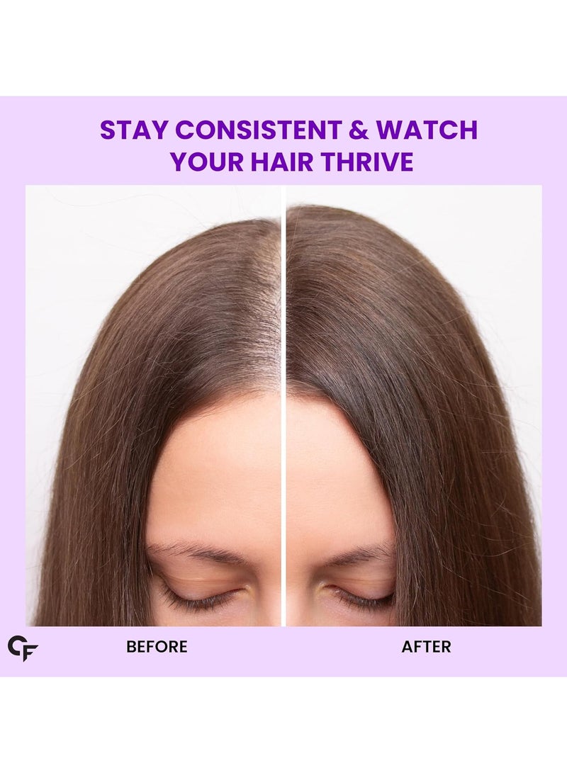 Carbamide Forte Biotin 10000mcg with Keratin and Bamboo Extract Tablets for Hair Growth for Women and Men - 90 Veg Tablets - Image 5