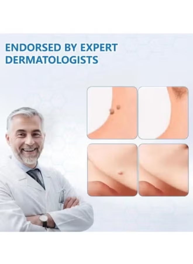 ساوث مون مرهم الثثول مع حمض الساليسيليك ، إزالة الثثول السريعة للعثول الشائعة ، الثثول النباتية ، الذرة ، وغيرها من نمو الجلد ، مرهم آمن وفعال (2pcs) - Image 2