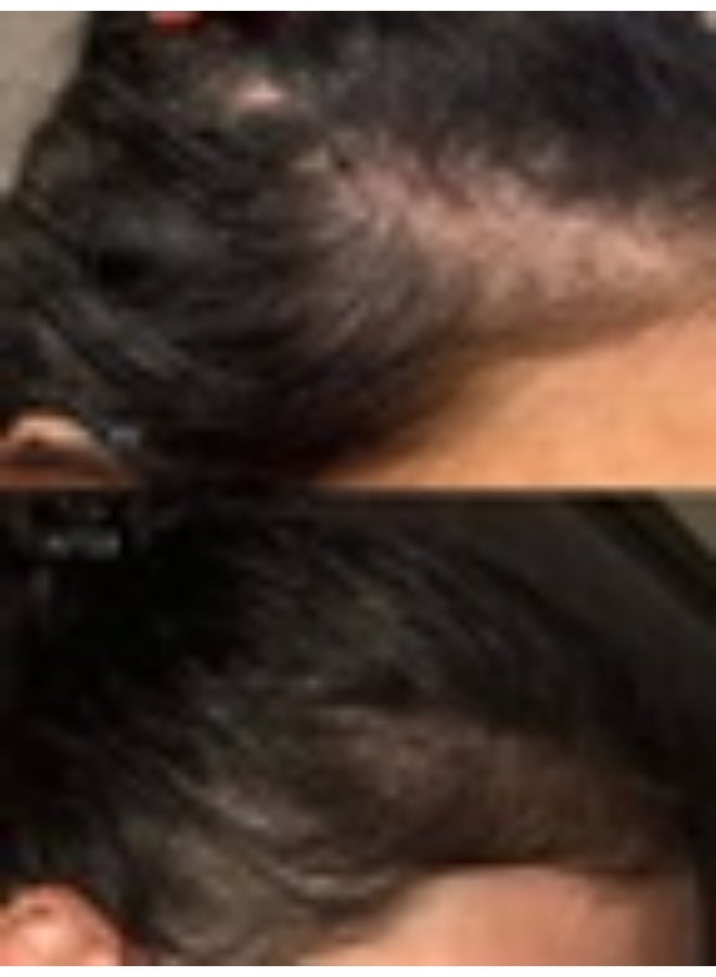 Sweed The Hair Serum 6ml - Image 2