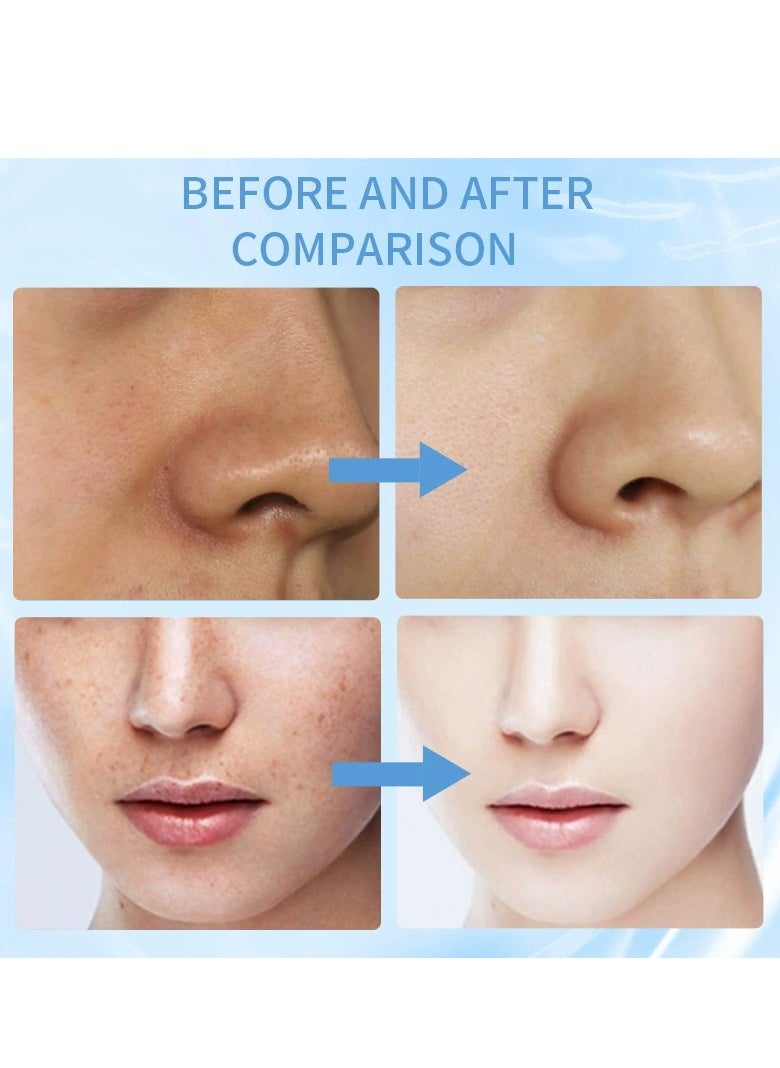 QANZIRE - Vitamin B3 Niacinamide Serum, Niacinamide Face Serum for Women & Men, Skin Brightening Serum Face Care, Anti Aging Serum for Face, Dark Spot Remover Serum, Hydrating Serum, Even Skin Tone 30ml - Image 1