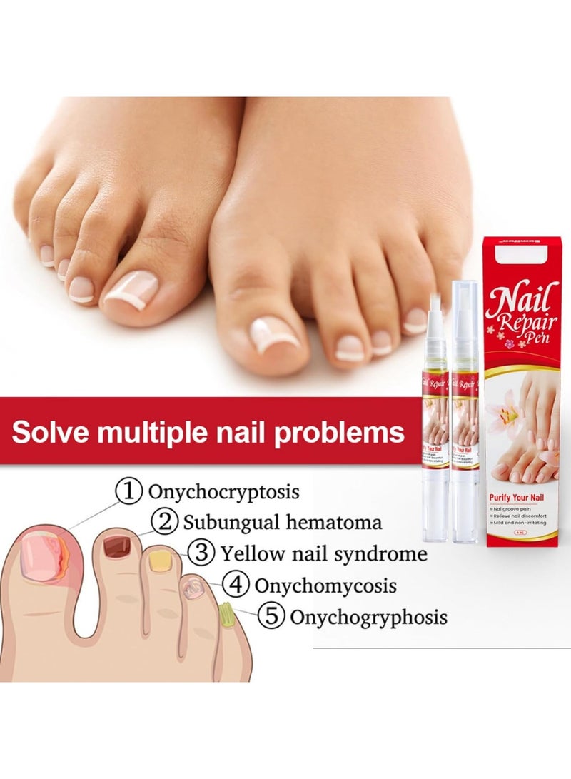 Sumifun Nail Repair Pen 4ml Antifungal Solution for Nail Repair, Targets Discoloration Gray & Black Nails, Antibacterial Pen for Nail Care, Enhances Nail Thickness & Cleanliness, Restores Healthy Nail - Image 3