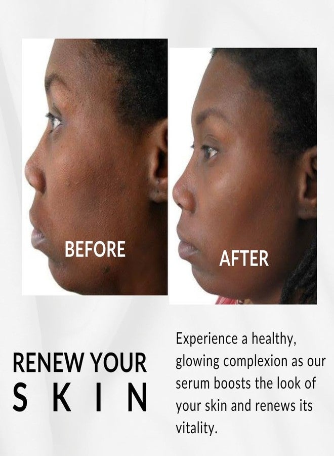 Flori Roberts Perfect Tone Moisture Serum by Flori Roberts, Reduces Appearance of Dark Spots, Hyperpigmentation, Lines and Wrinkles, Boosts Radiance - Image 3