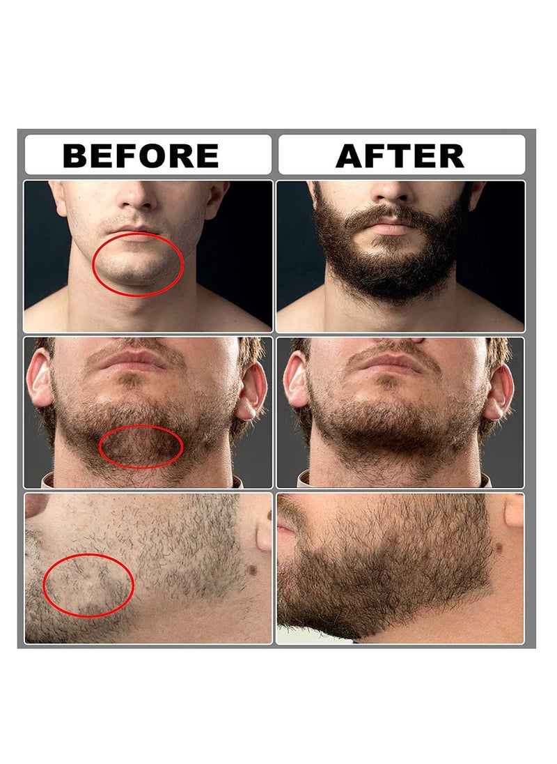 NNEWVANTE - Beard Growth Kit, Beard Kit for Men, Beard Growth Oil (2oz), Beard Balm and Comb, Stimulate Beard and Hair Growth - Gifts for Men Dad Him Boyfriend Husband Brother - Image 1