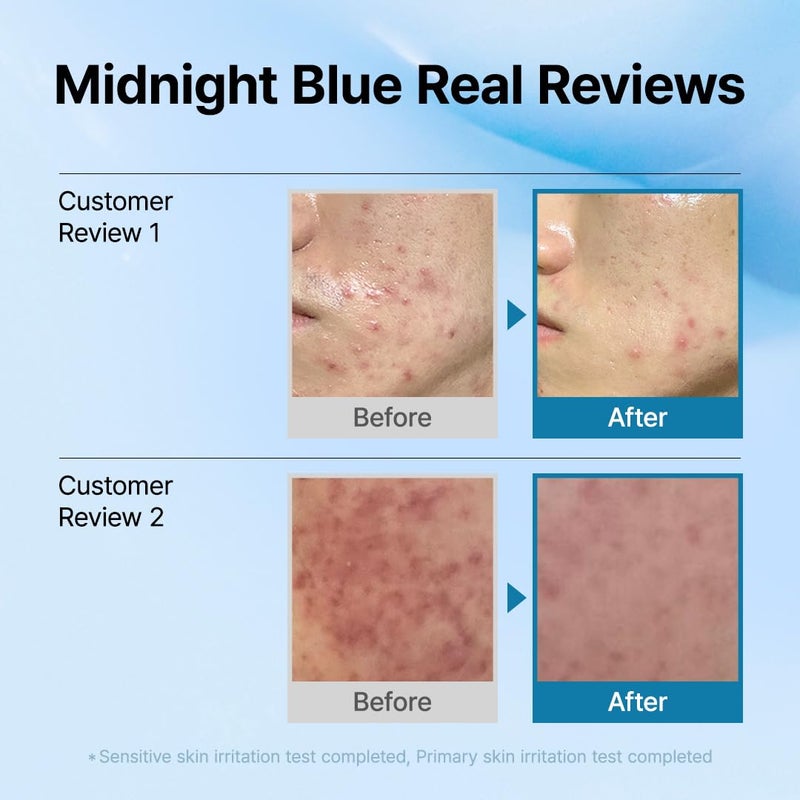 Klairs Blue Comforting Duo | Calming&Rich Moist Soothing Creams for Deep Moisture, Korean Skin Care for Dry, Sensitive Skin - Image 5
