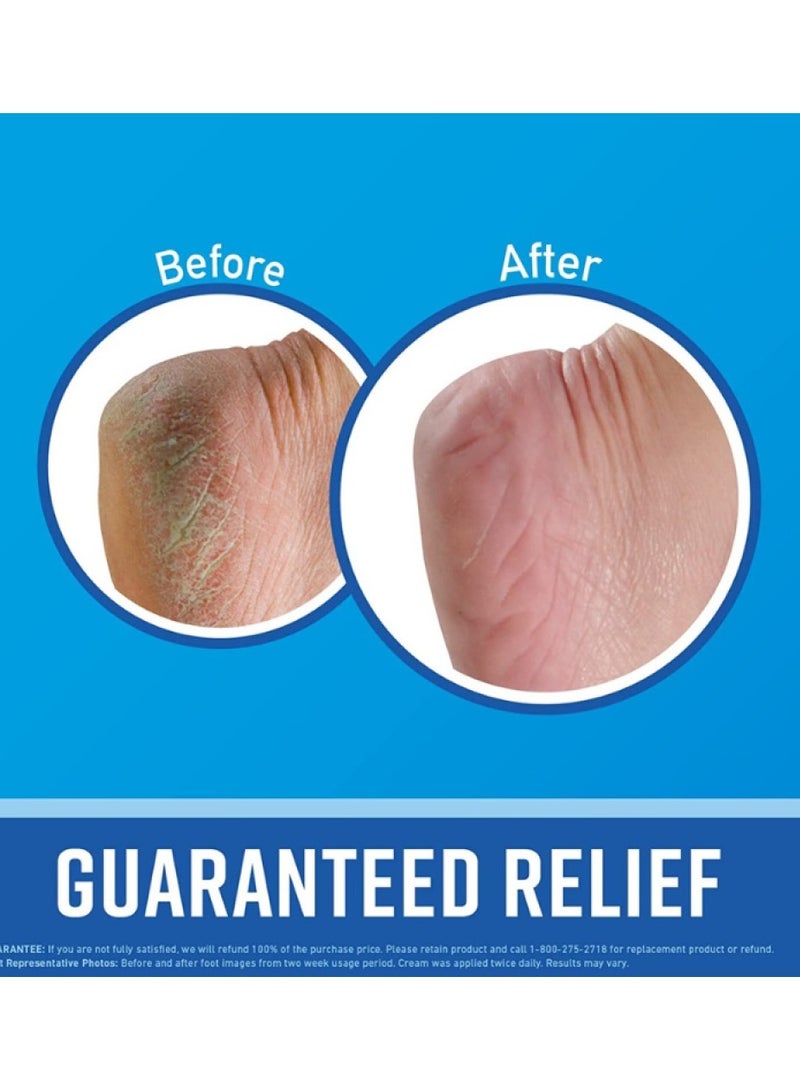 O'Keeffe's O'Keeffe Healthy Feet Foot Cream treats dry, cracked feet and instantly boosts hydration levels, 76g/2.7oz, (Pack of 1) - Image 2