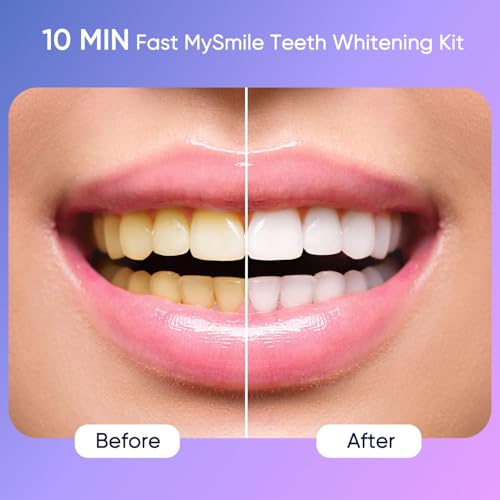 MySmile Deluxe 10 Min Teeth Whitening Kit with 28 LED Light 35 Carbamide Peroxide Teeth Whitening Gel Helps Remove Years of Stains from Coffee Soda Wines Smoking Food - Image 3