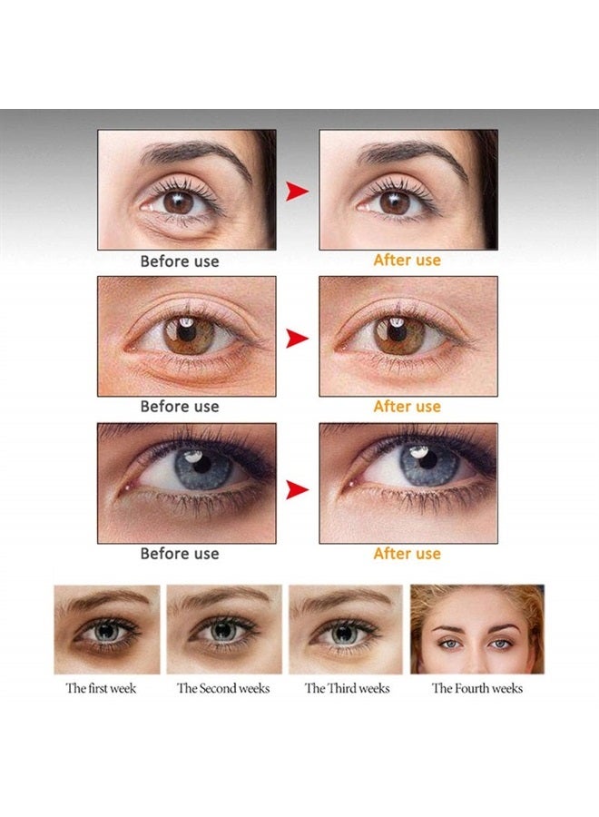 MIESCHER Eye Peptide Serum Eye Massage Roller Nourishing Relieve Loose Eye Bags Dark Circles Eye Skin Care Under Eye Cream for Fine Wrinkles and Puffiness Daily Skincare(Nourishing Grey) 