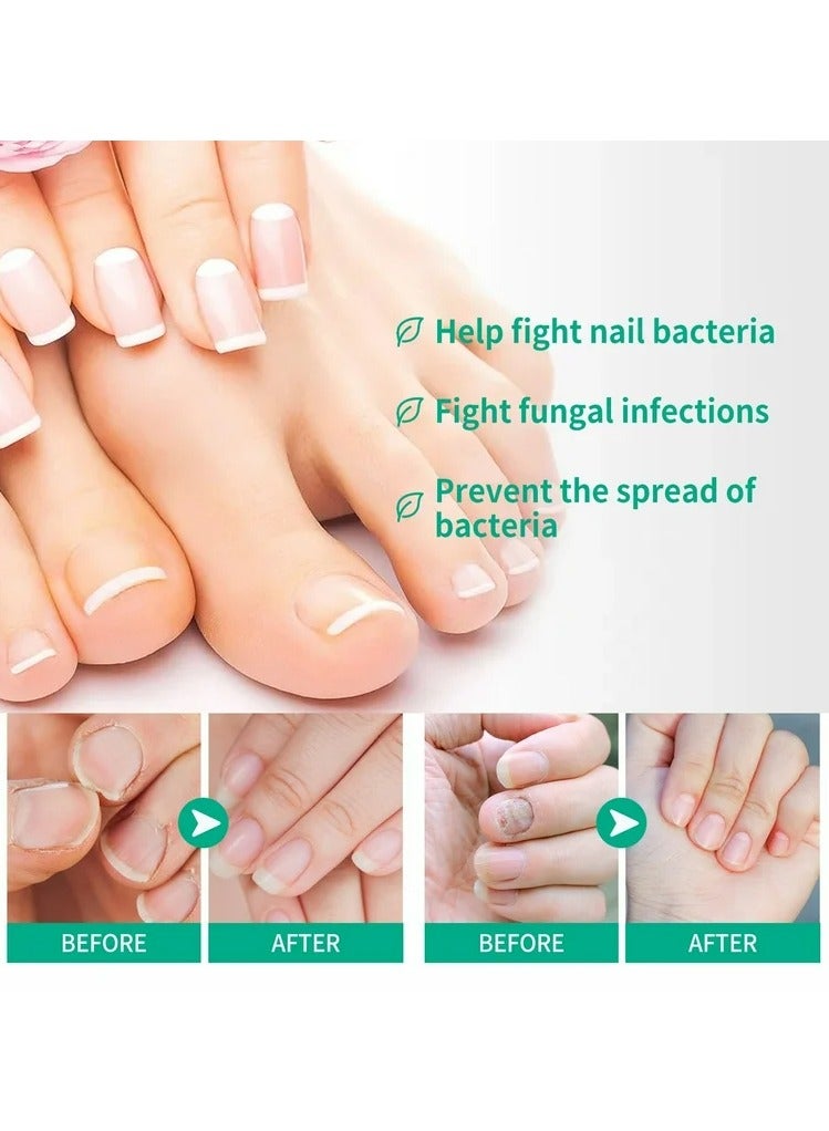 Karlash Fungus Solution for Hands &  Feet, 0.5 fl.oz - Image 3