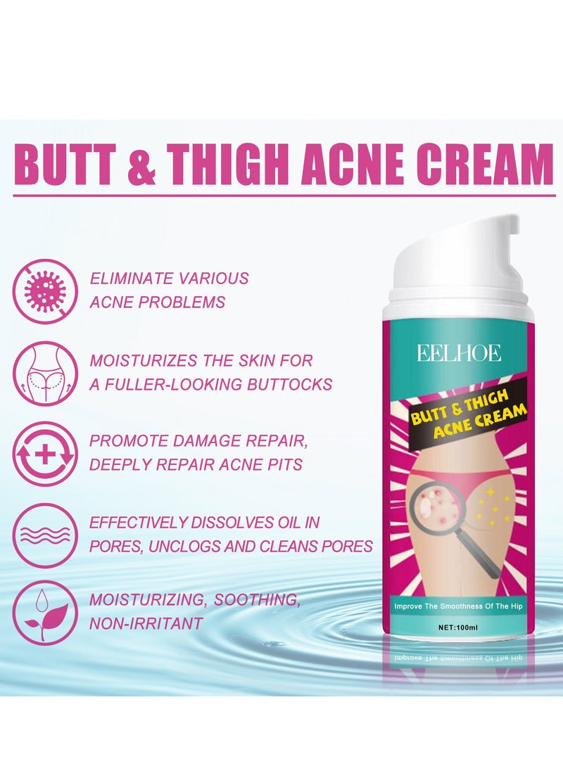 EELHOE - Moisture Emulsion Skincare Body Cream – Butt & Thigh Acne Treatment, 100ml, Deep Hydrating and Nourishing Moisturizer for Clearer, Smoother Skin - Image 1