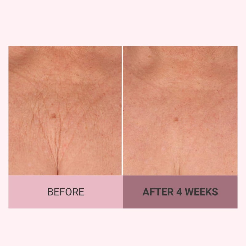 Consult Beaute كريم الجسم المرطب والمشدود من كونسل بيوتي بشامبانيا لرفع البشرة مع فلفل الورد للبشرة المتجعدة - 8 أونصات - Image 4