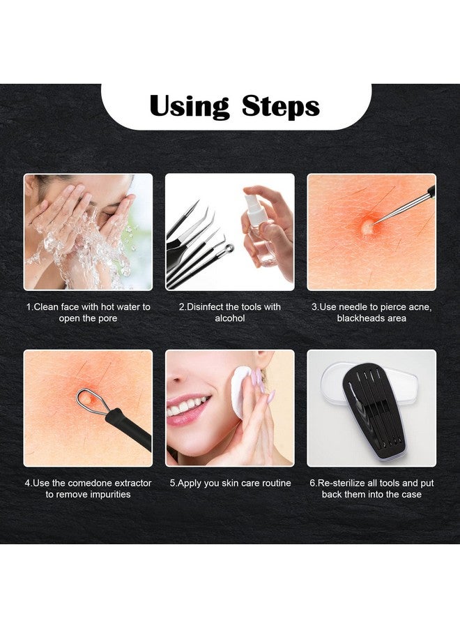 FVION Blackhead And Acne Extractor Kit Professional Pimple Popper Tool Kit Acne Tweezers And Blackhead Remover Tools For Face 5 Pcs Surgical Extractor Pimple Popping Tools - Image 5