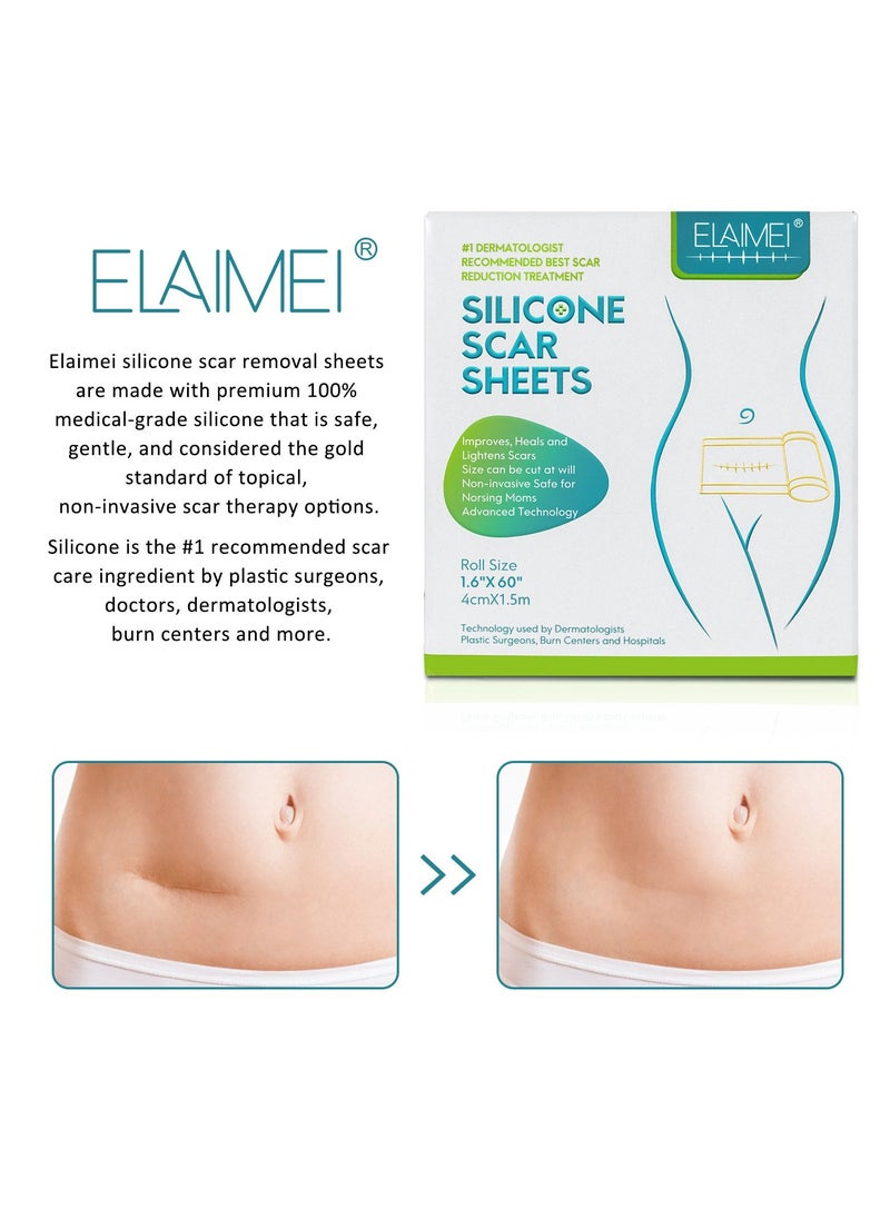 Elaimei 4cm*1.5m Fade Scar Sticker Efficient Beauty Scars Removal Silicone Gel Skin Tone Self-adhesive Acne Burn Repair Patch  - Image 3