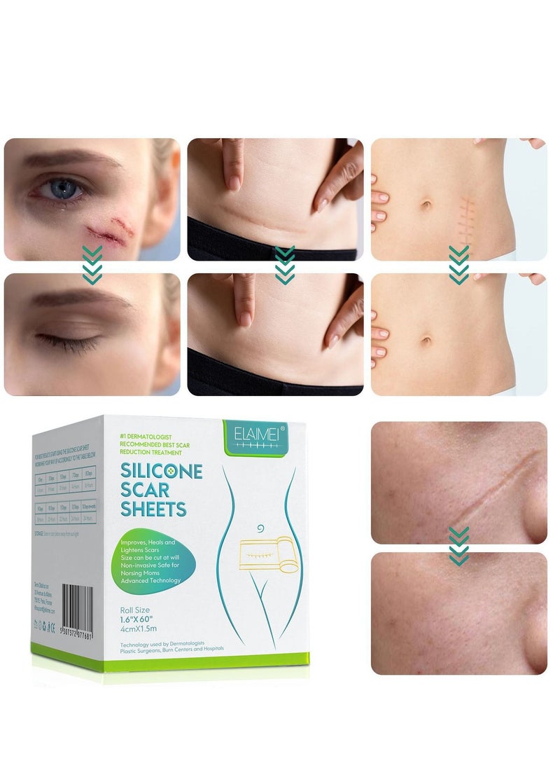 Elaimei 4cm*1.5m Fade Scar Sticker Efficient Beauty Scars Removal Silicone Gel Skin Tone Self-adhesive Acne Burn Repair Patch  - Image 4