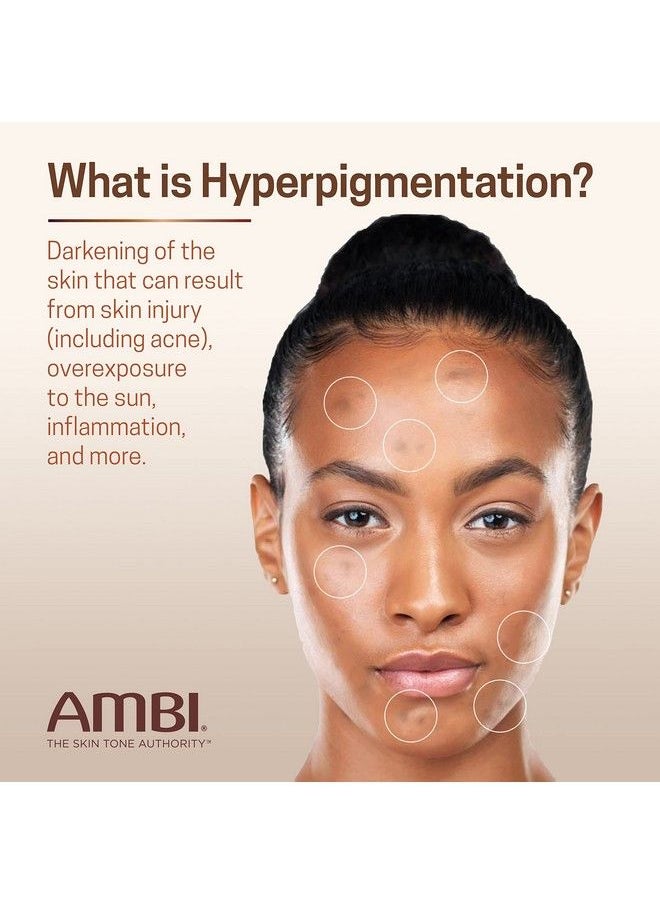 ambi - Even & Clear Advanced Fade Cream Hydroquinonefree Hyperpigmentation Treatment Stubborn Dark Spot Corrector Results In As Little As 23 Weeks Niacinamide Licorice Root Extract Pha 1 Fl Oz - Image 1