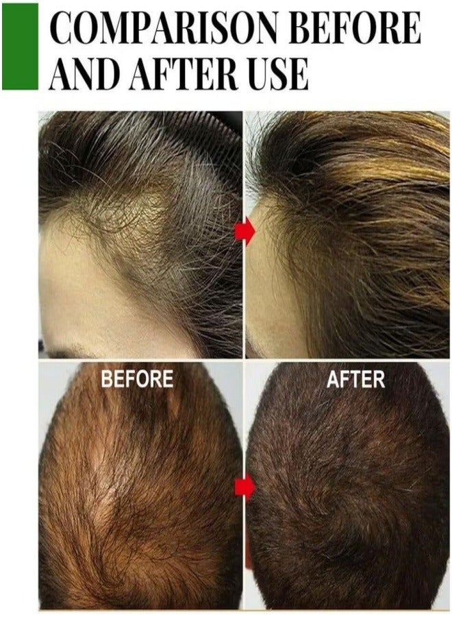 إيلهو زيت الروزماري للعناية بالشعر - Image 2