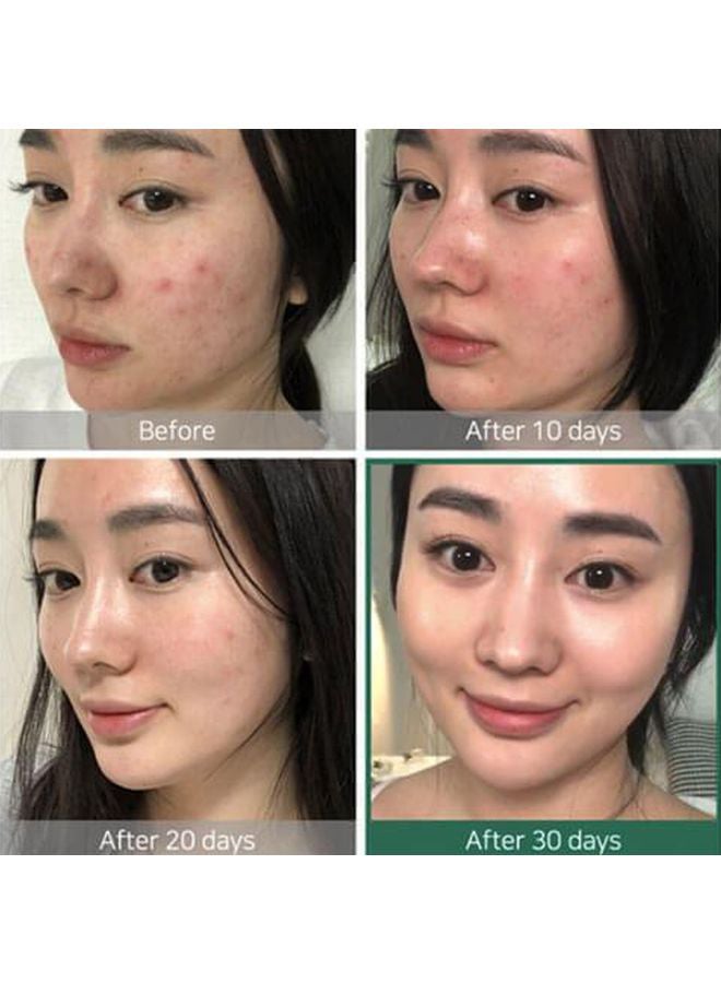 Some by Mi AHA-BHa-PHA 30 Days Miracle Toner 150ml + Miracle Cream Clear 60grams - Image 4