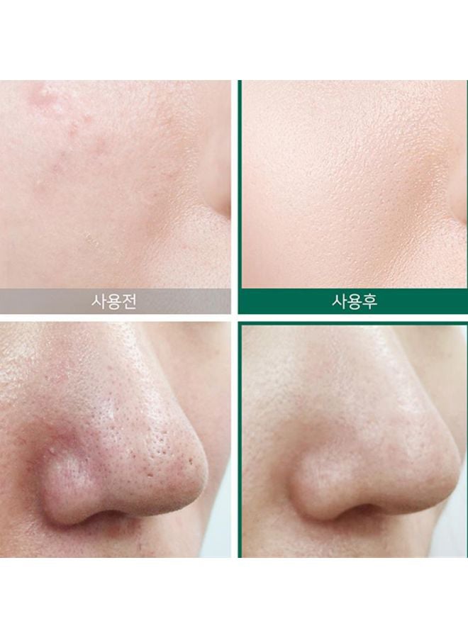 Some by Mi AHA-BHa-PHA 30 Days Miracle Toner 150ml + Miracle Cream Clear 60grams - Image 5
