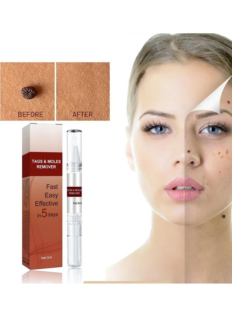 Wipeoff Tags & Moles Remove,Wipeoff Tags & Moles Remover Fast Easy Effective in 5 Days,Natural Non-Irritating Liquid Moles Pen, Easy Removal of Skin Tags & Moles for Face, for All Body Parts